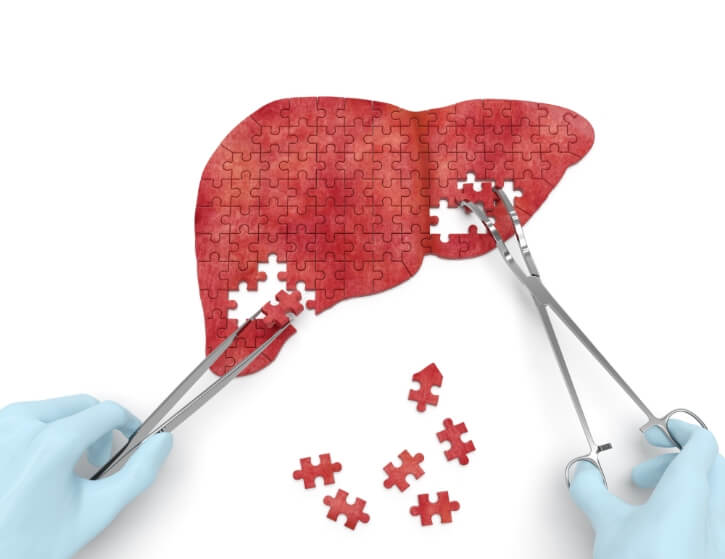 Liver Health